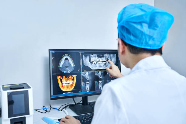 Best Emergency Wisdom Tooth Extraction in Columbia Heights, MN